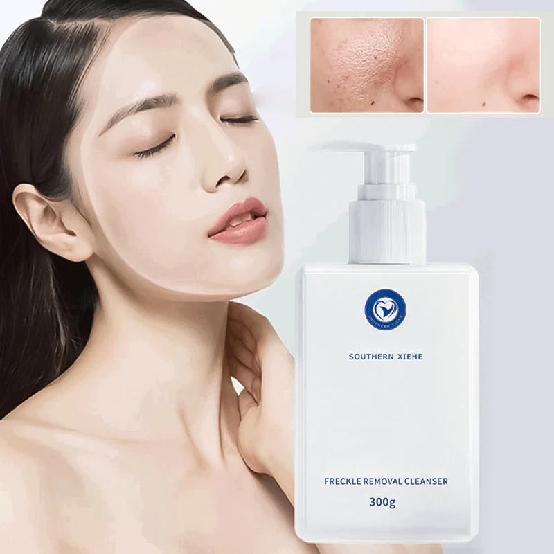 Southern Xiehe Niacinamide blegende ansigtsrens