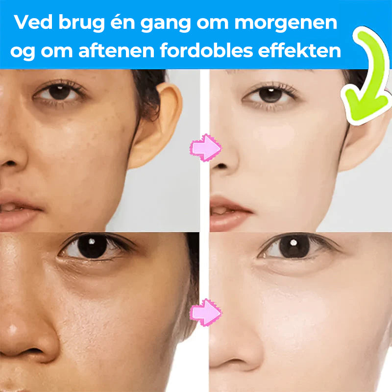 Southern Xiehe Niacinamide blegende ansigtsrens