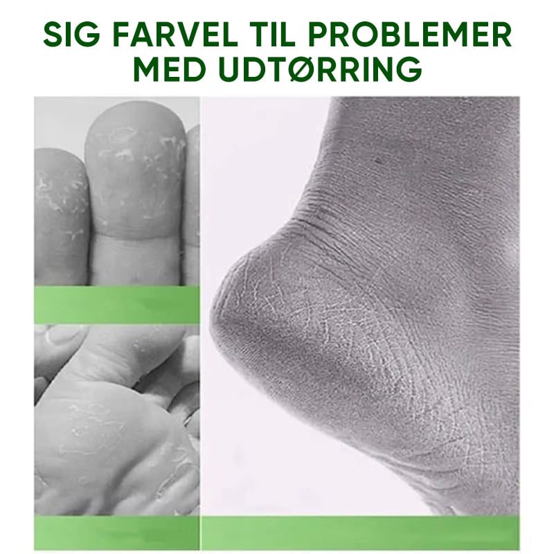 Fodcreme med Tea tree olie