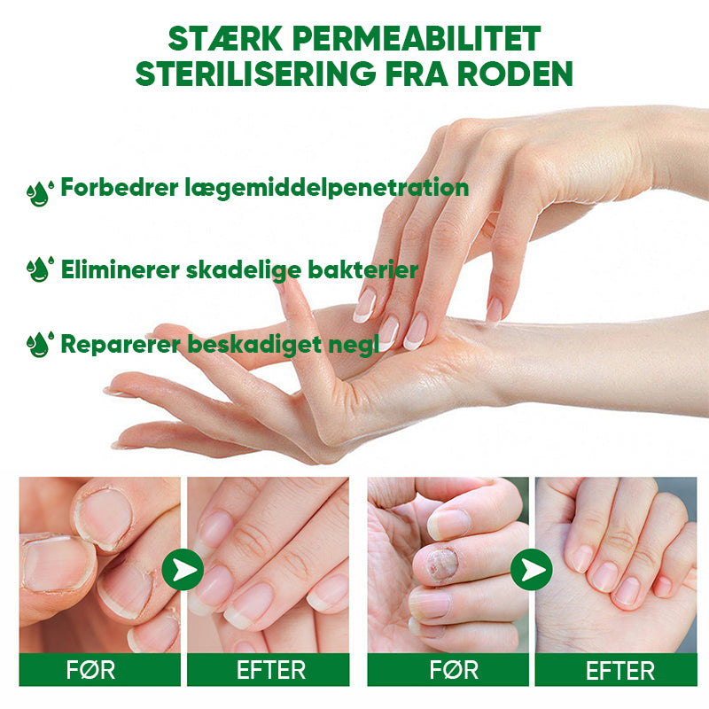Ingefær essens til neglebehandling