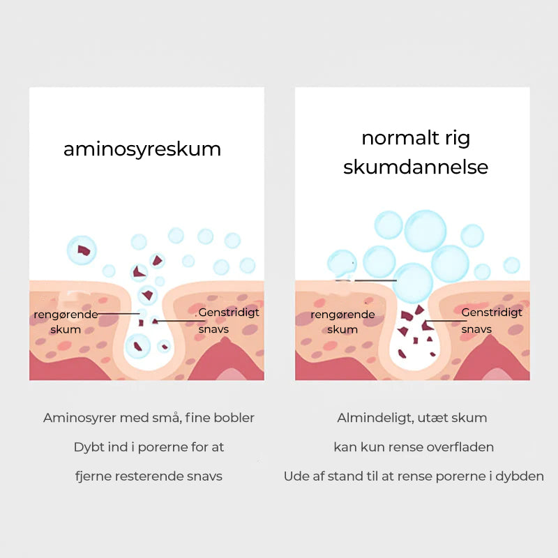 Southern Xiehe Niacinamide blegende ansigtsrens