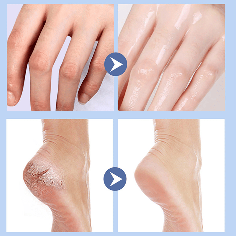 Plejende fodcreme