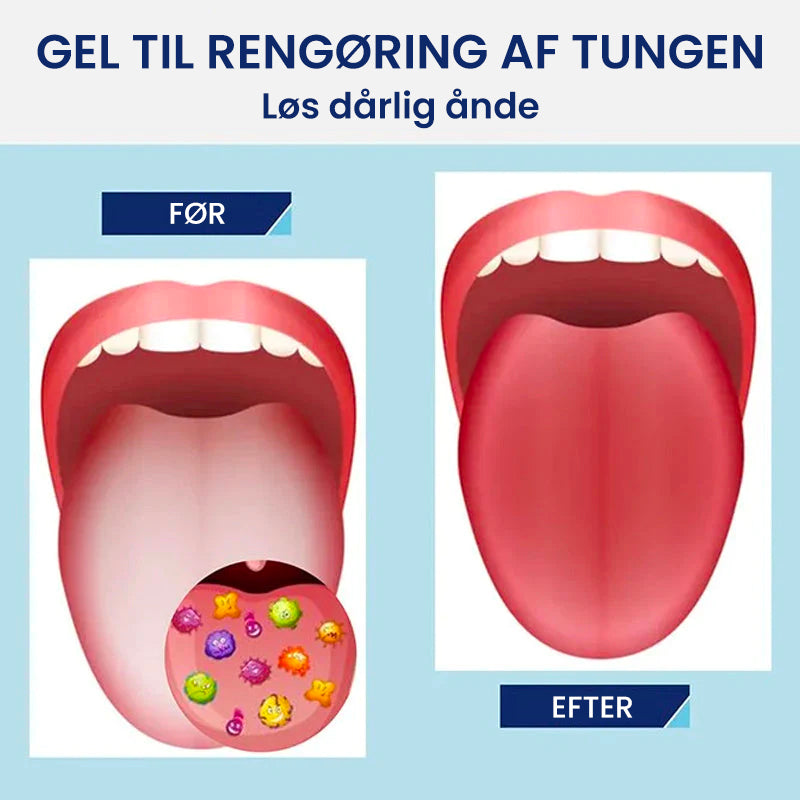 Tungerensnings-gel sæt