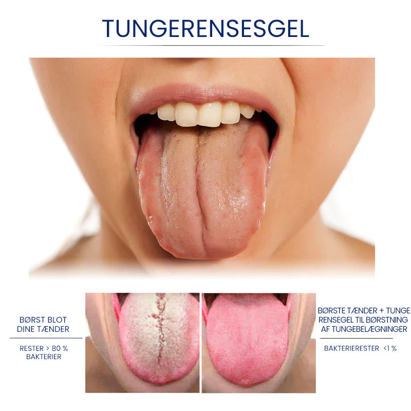 Tungerensnings-gel sæt